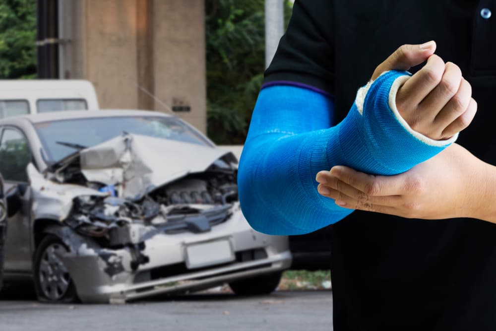 humerus fracture