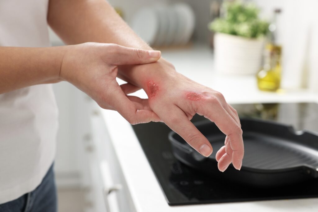 Severe injuries